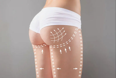 How to Get a Bigger Butt Without Surgery: Natural and Non-Invasive Methods