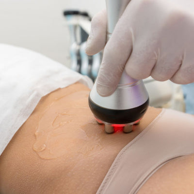 How to Tighten Excess Skin Without Surgery
