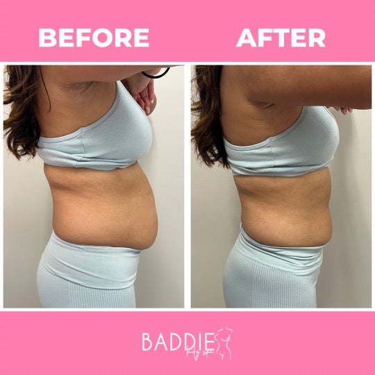 Cold Slim Gel