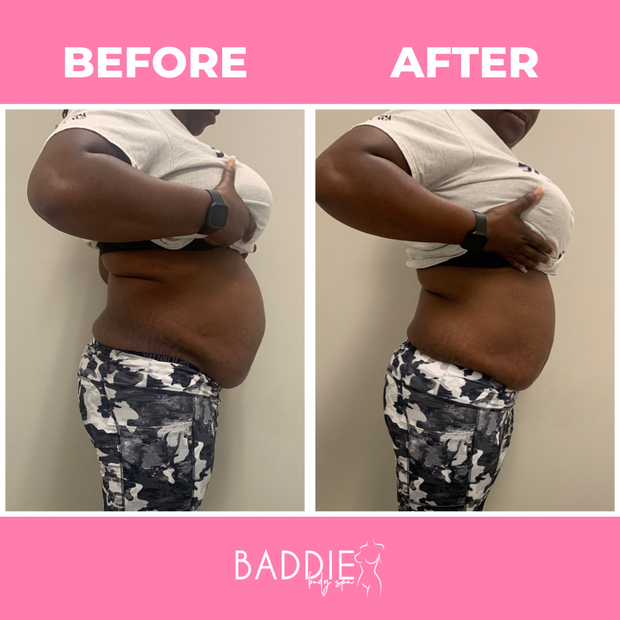 Cold Slim Gel