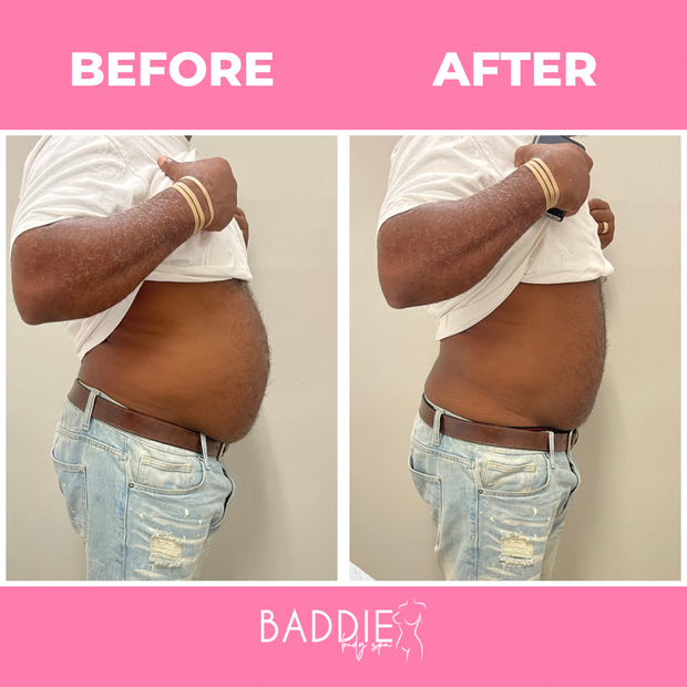 Cold Slim Gel